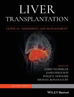Liver Transplantation: Clinical Assessment and Management by James Neuberger