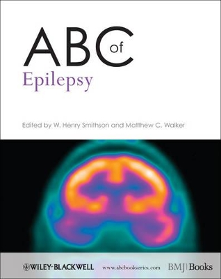 ABC of Epilepsy book