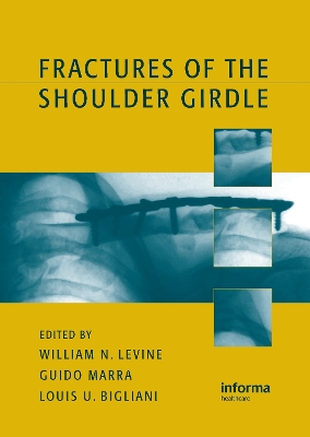 Fractures of the Shoulder Girdle book