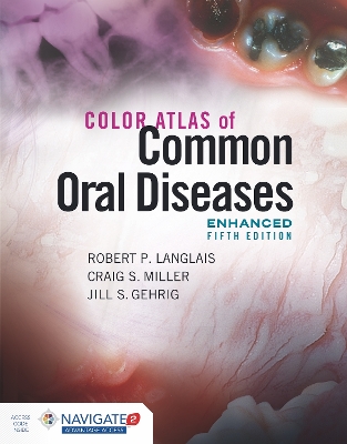 Color Atlas of Common Oral Diseases, Enhanced Edition book