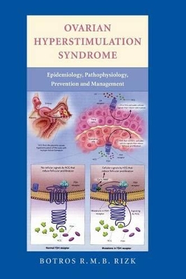 Ovarian Hyperstimulation Syndrome book