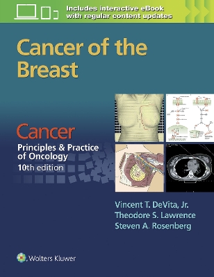Cancer of the Breast book