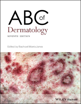 ABC of Dermatology book