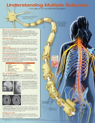 Understanding Multiple Sclerosis Anatomical Chart book