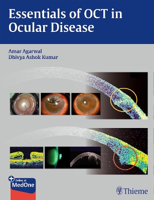 Essentials of OCT in Ocular Disease book