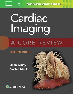 Cardiac Imaging: A Core Review book