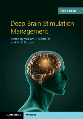 Deep Brain Stimulation Management book