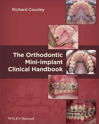 The Orthodontic Mini–implant Clinical Handbook book