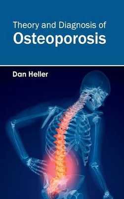 Theory and Diagnosis of Osteoporosis by Dan Heller