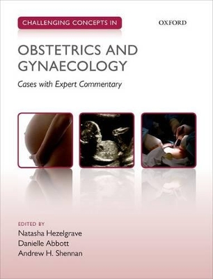 Challenging Concepts in Obstetrics and Gynaecology by Natasha Hezelgrave