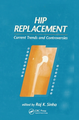 Hip Replacement: Current Trends and Controversies book