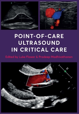 Point-of-Care Ultrasound in Critical Care book