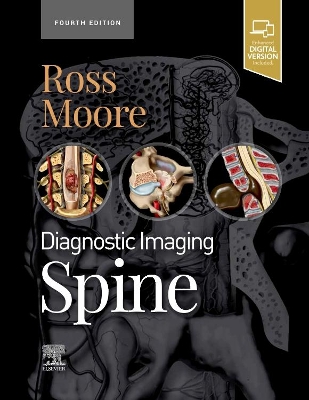 Diagnostic Imaging: Spine book
