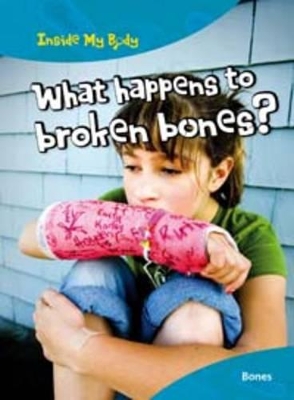What Happens to Broken Bones? by Carol Ballard