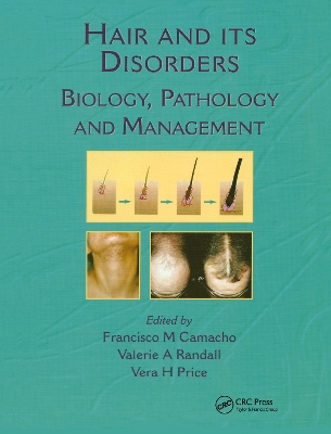 Hair and Its Disorders book