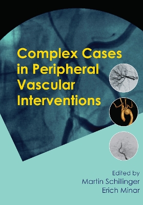 Complex Cases in Peripheral Vascular Interventions by Martin Schillinger