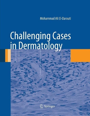 Challenging Cases in Dermatology book